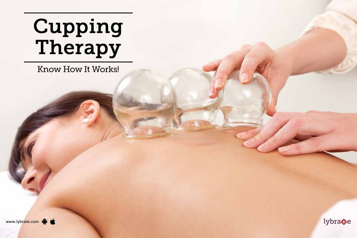 Cupping Therapy - Know How It Works!