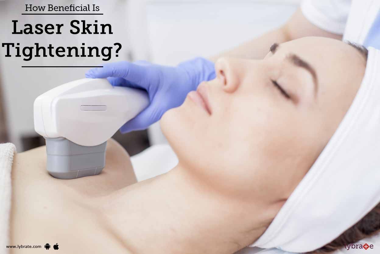 How Beneficial Is Laser Skin Tightening?
