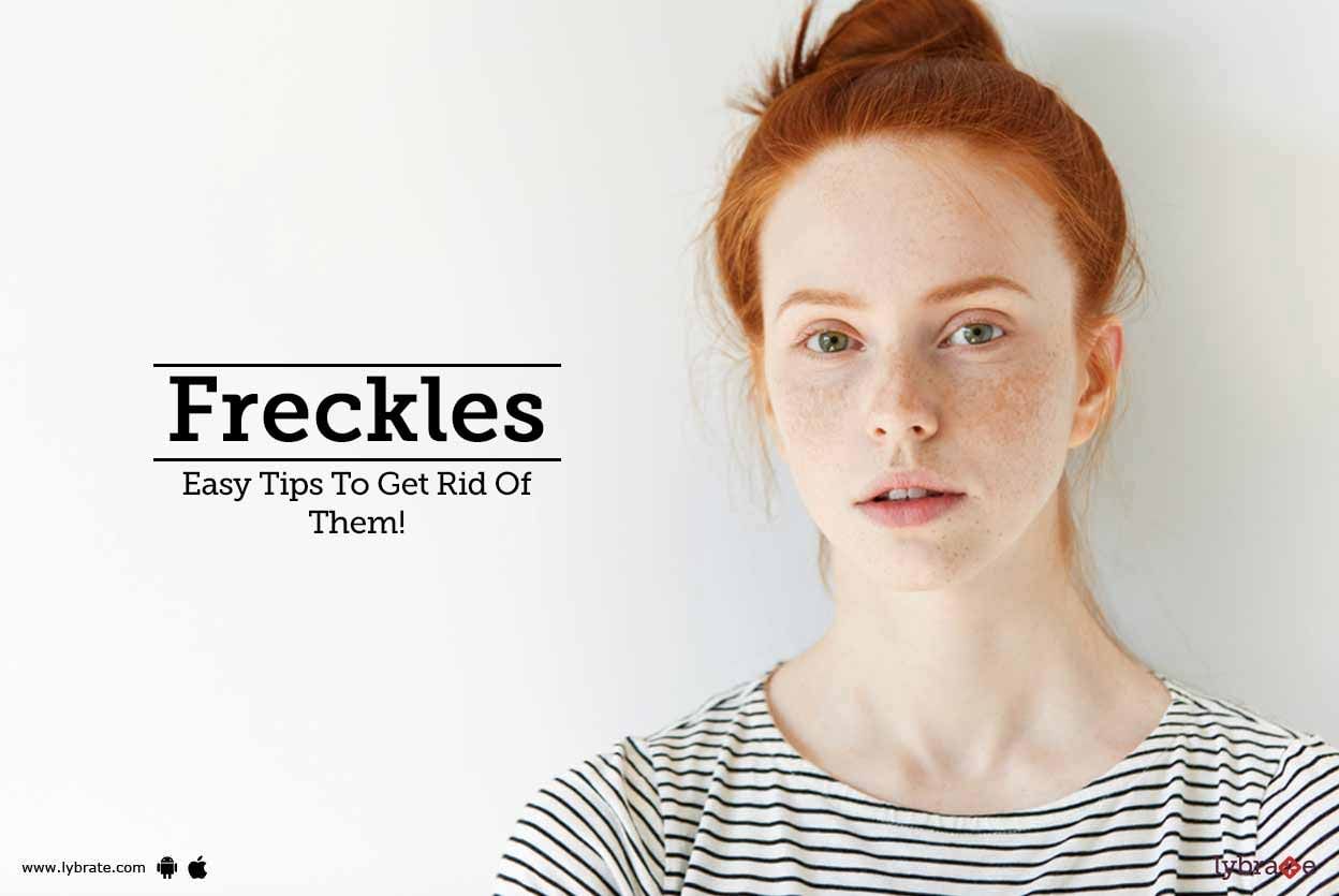 Freckles - Easy Tips To Get Rid Of Them!