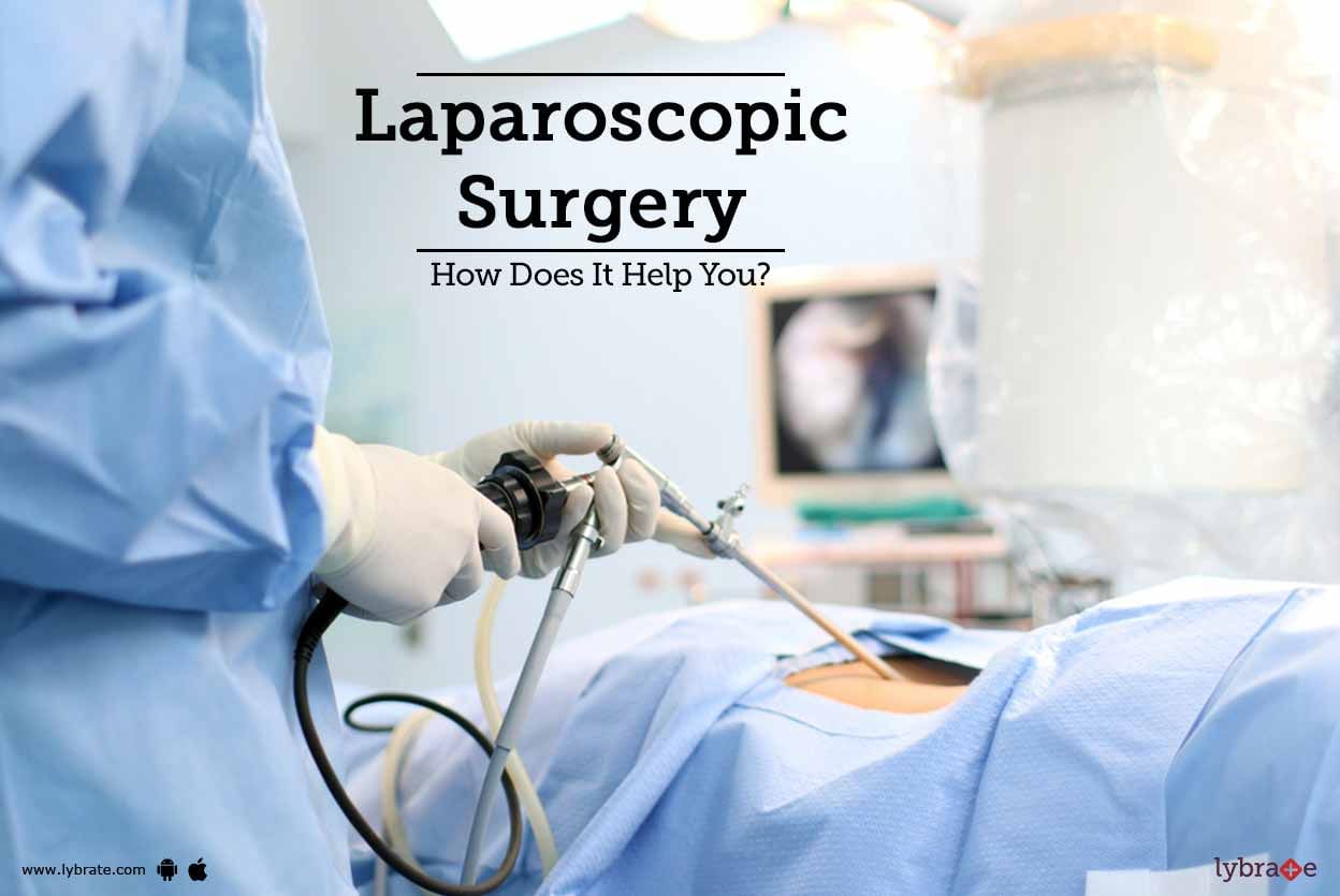 Laparoscopic Surgery - How Does It Help You?
