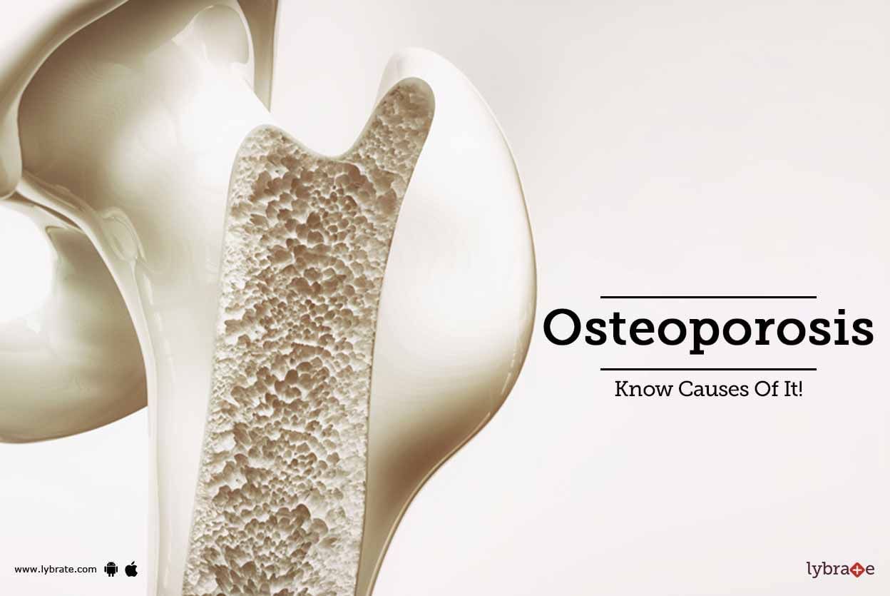 Osteoporosis - Know Causes Of It!