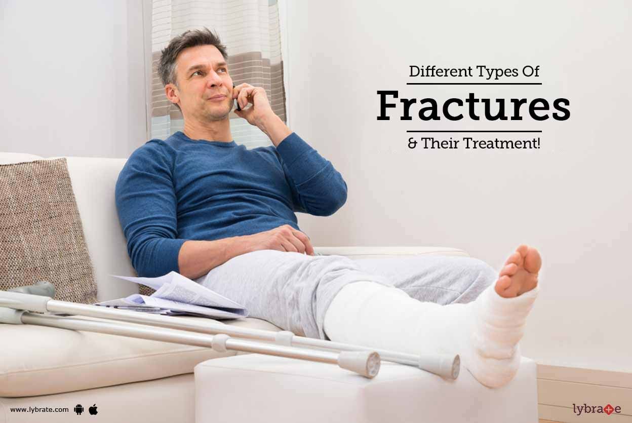 Different Types Of Fractures & Their Treatment!