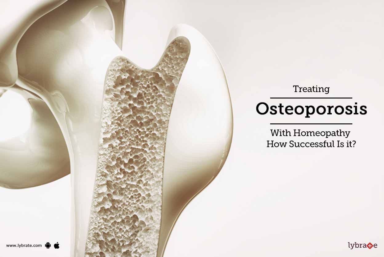 Treating Osteoporosis With Homeopathy - How Successful Is it?