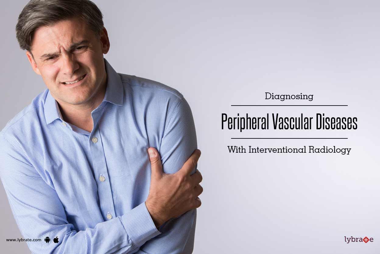 Diagnosing Peripheral Vascular Diseases With Interventional Radiology