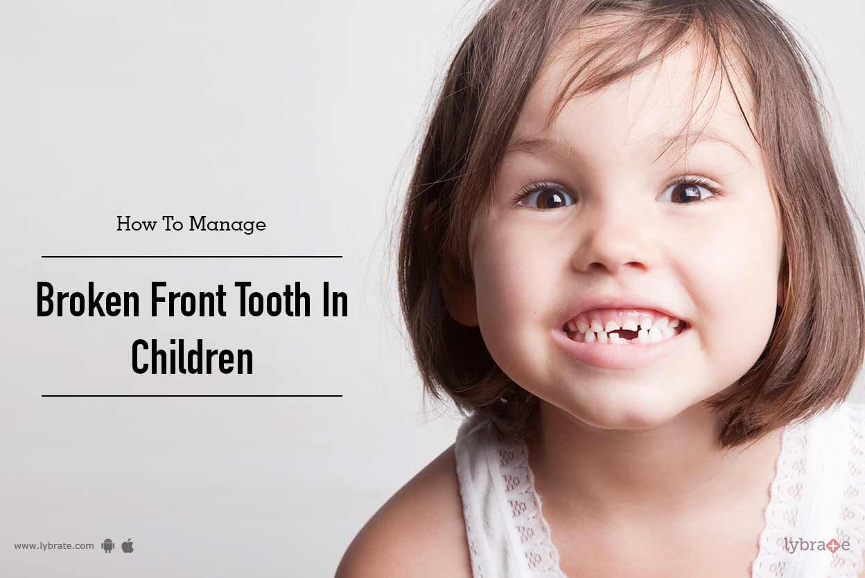 How To Repair Chipped Front Tooth In Child