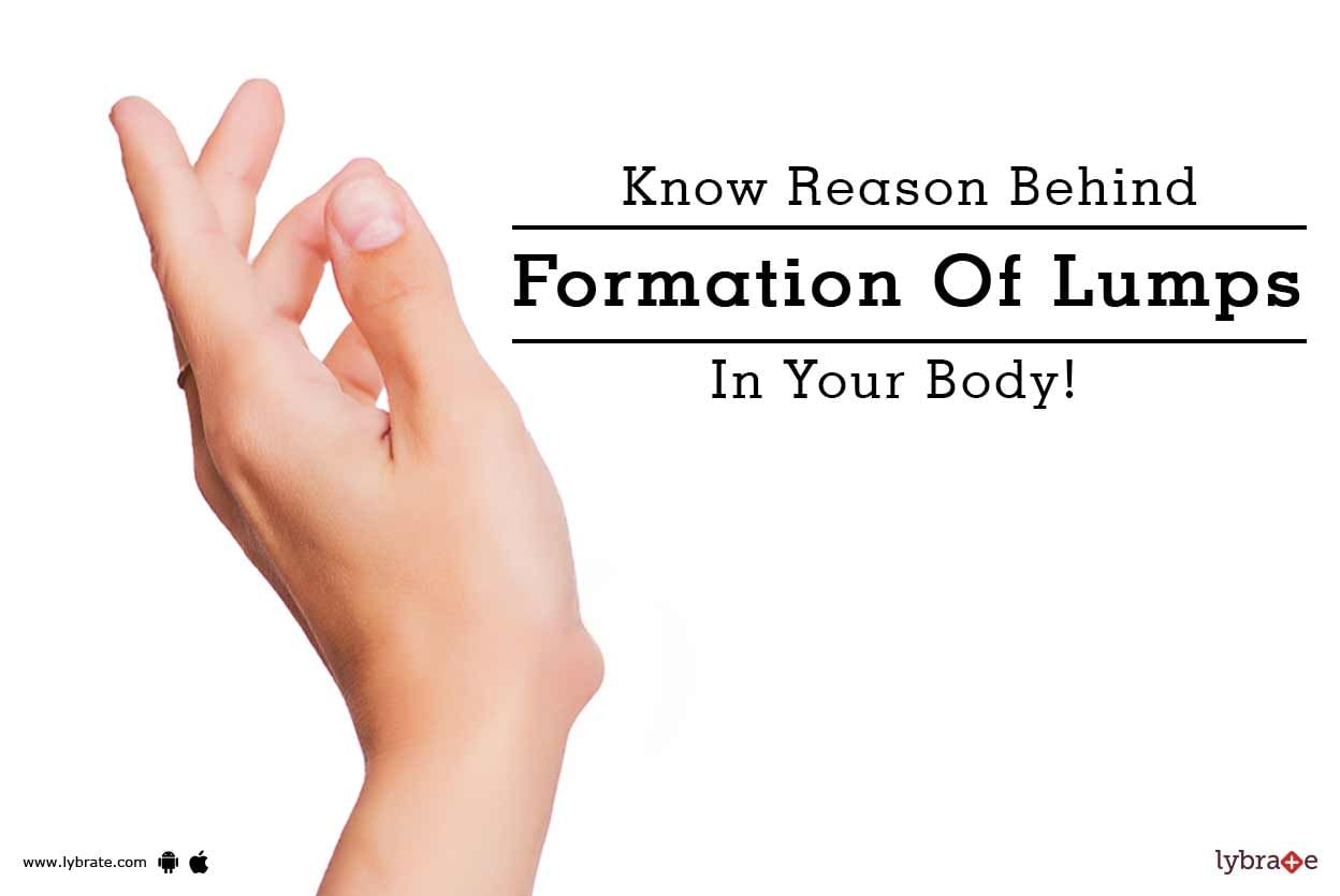 Know Reason Behind Formation Of Lumps In Your Body!