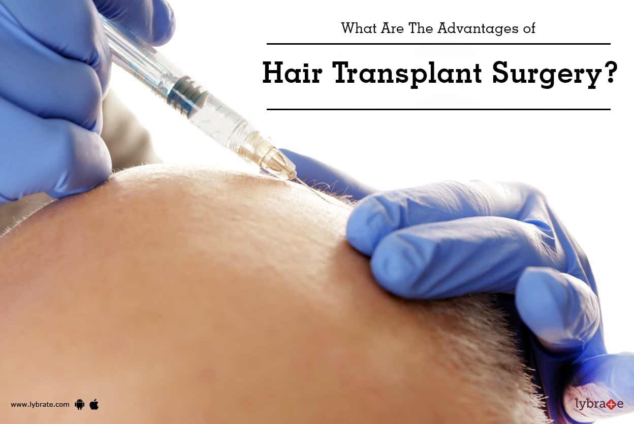 What Are The Advantages of Hair Transplant Surgery?