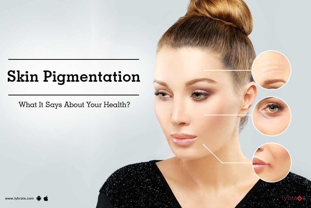 Skin Pigmentation - What It Says About Your Health?