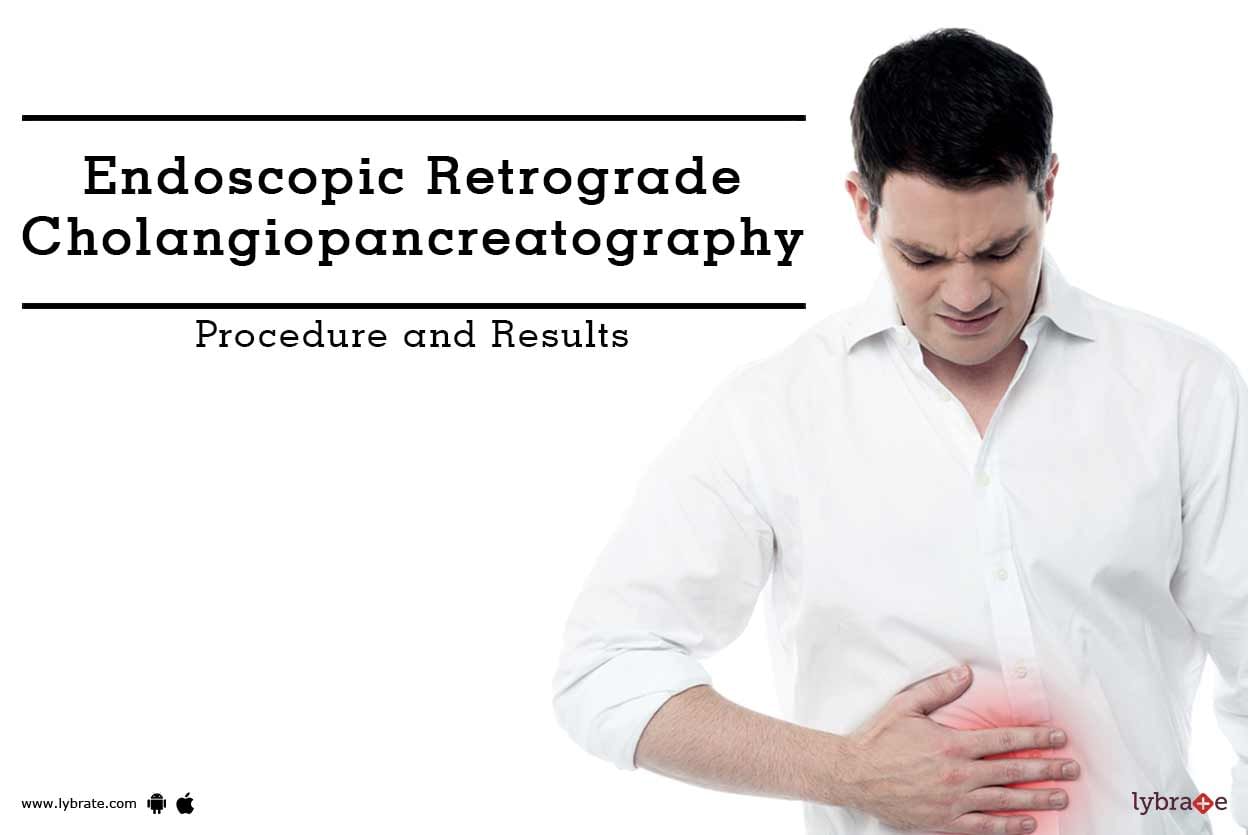 Endoscopic Retrograde Cholangiopancreatography - Procedure and Results
