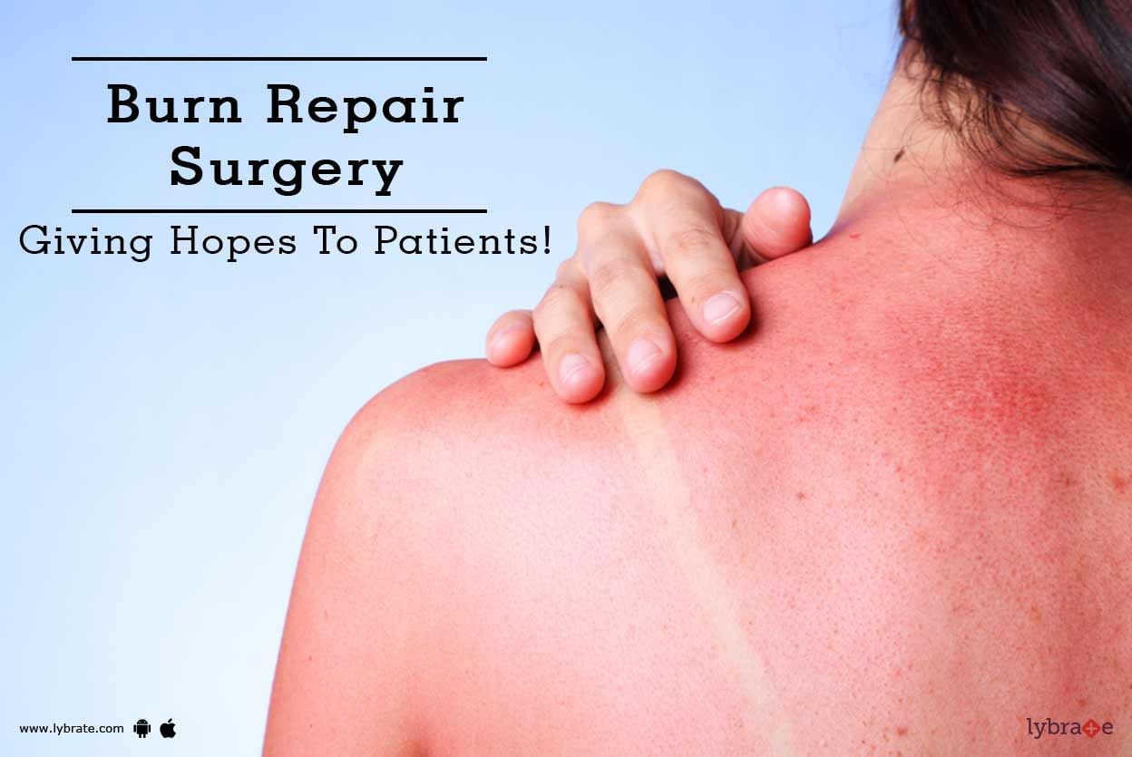 Burn Repair Surgery - Giving Hopes To Patients!