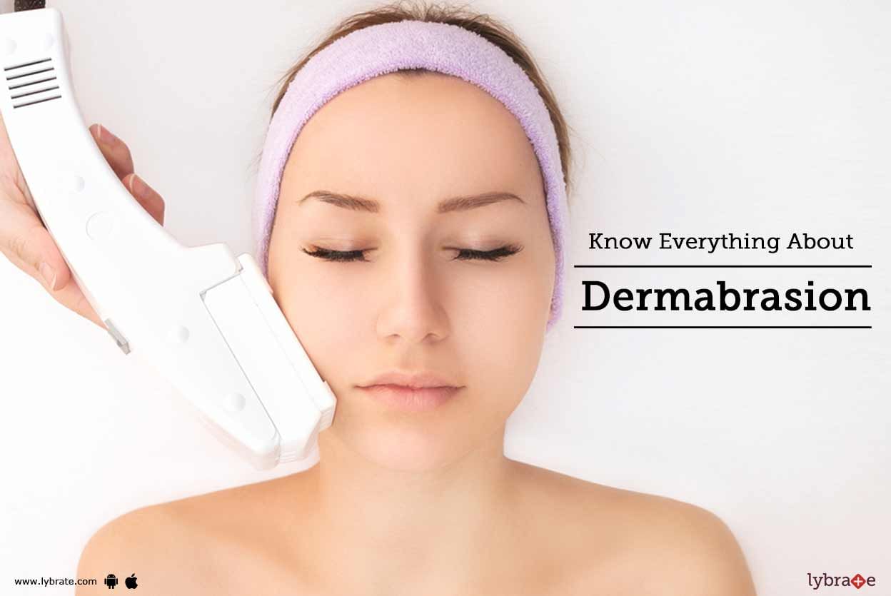 Know Everything About Dermabrasion