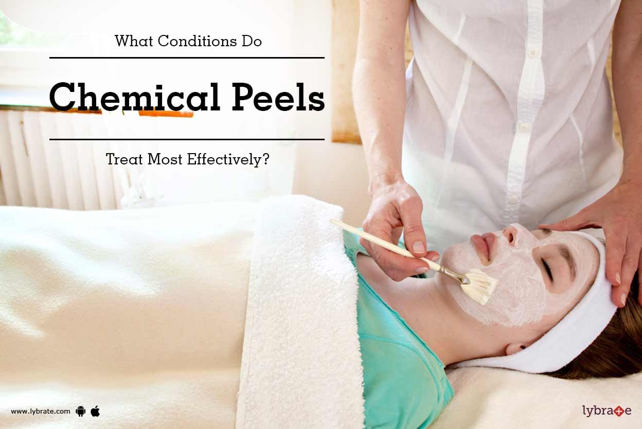 What Conditions Do Chemical Peels Treat Most Effectively?