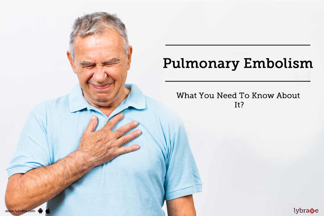 Pulmonary Embolism: What You Need To Know About It?