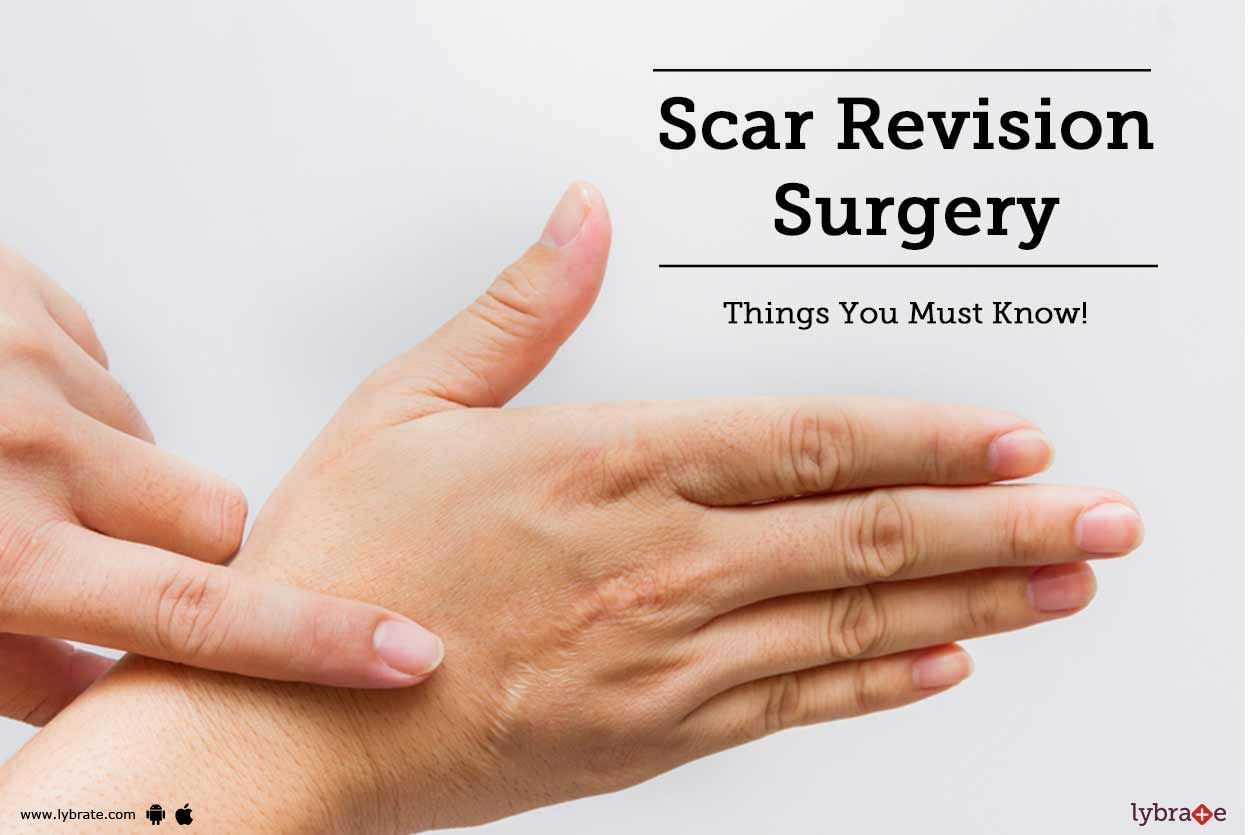 Scar Revision Surgery - Things You Must Know!