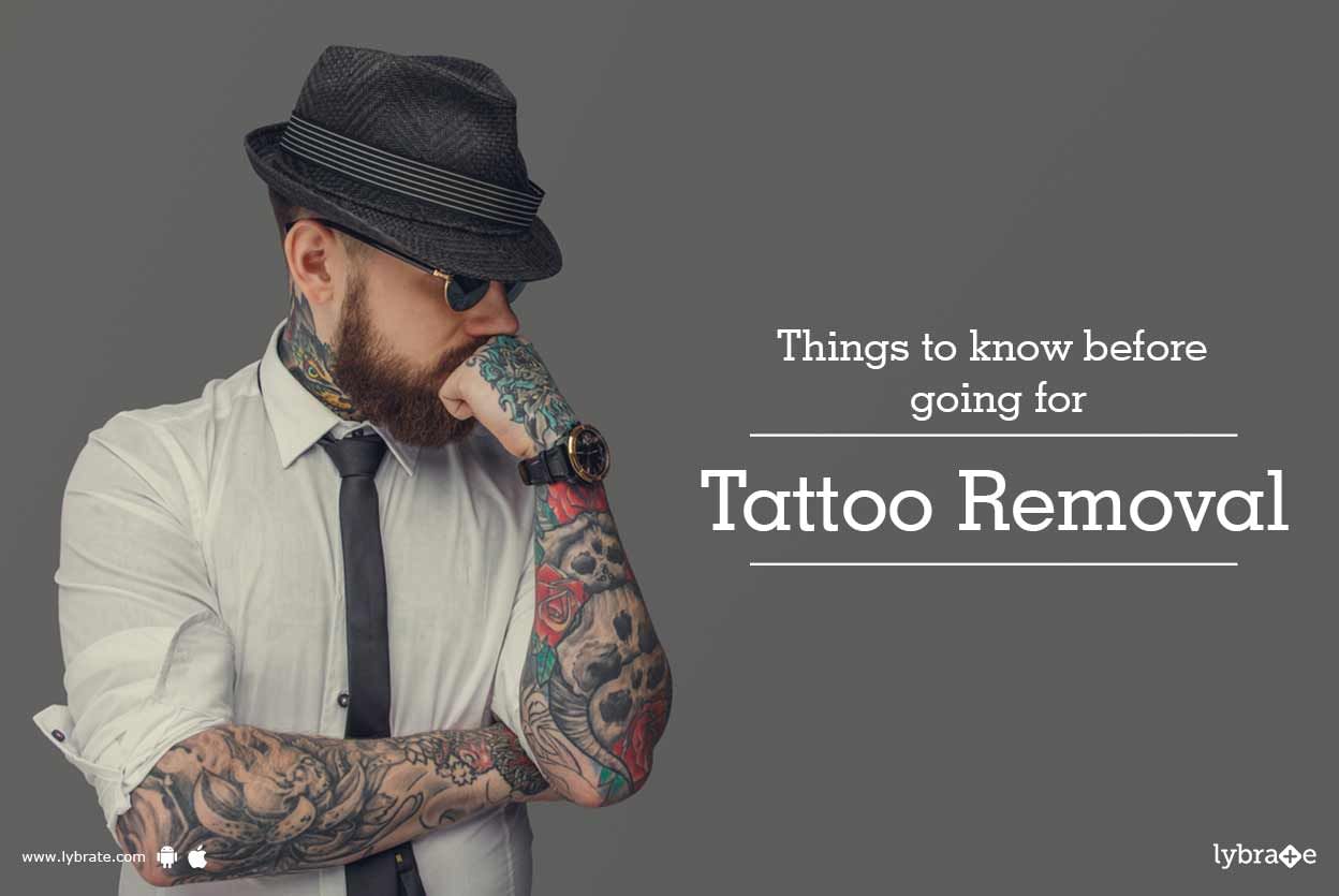 Things To Know Before Going For Tattoo Removal
