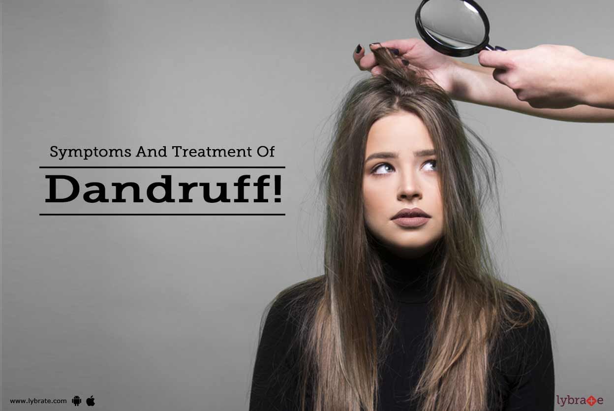Symptoms And Treatment Of Dandruff!