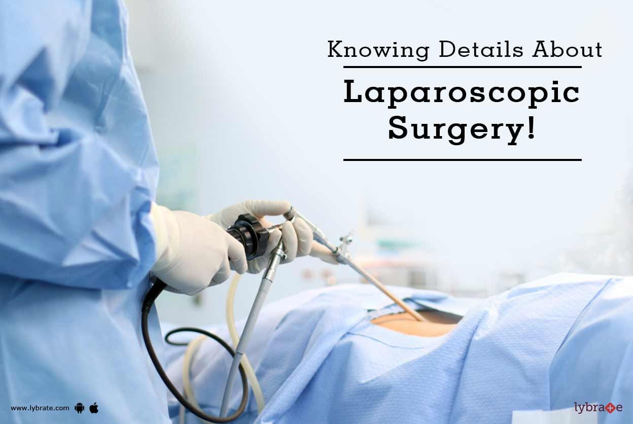 Knowing Details About Laparoscopic Surgery!