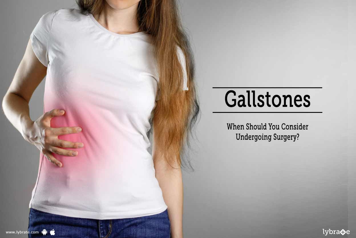 Gallstones: When Should You Consider Undergoing Surgery?