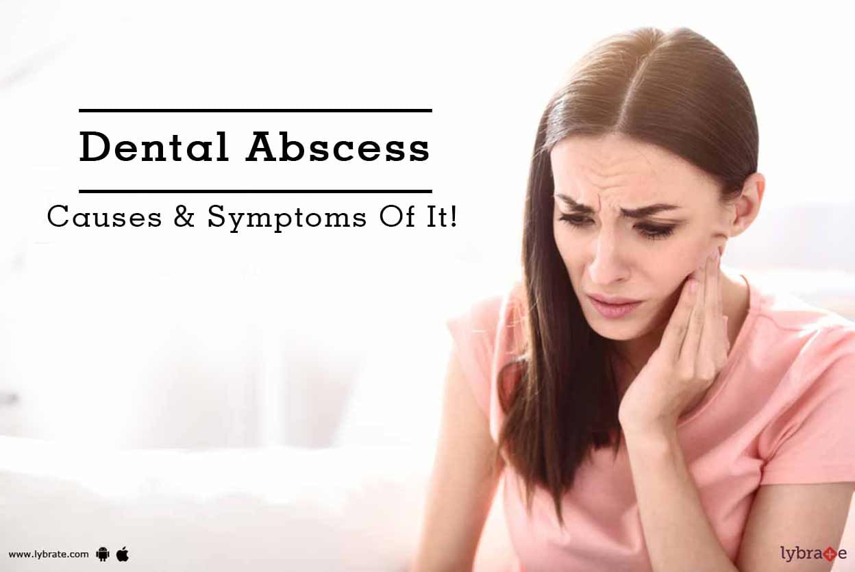 Dental Abscess - Causes & Symptoms Of It!