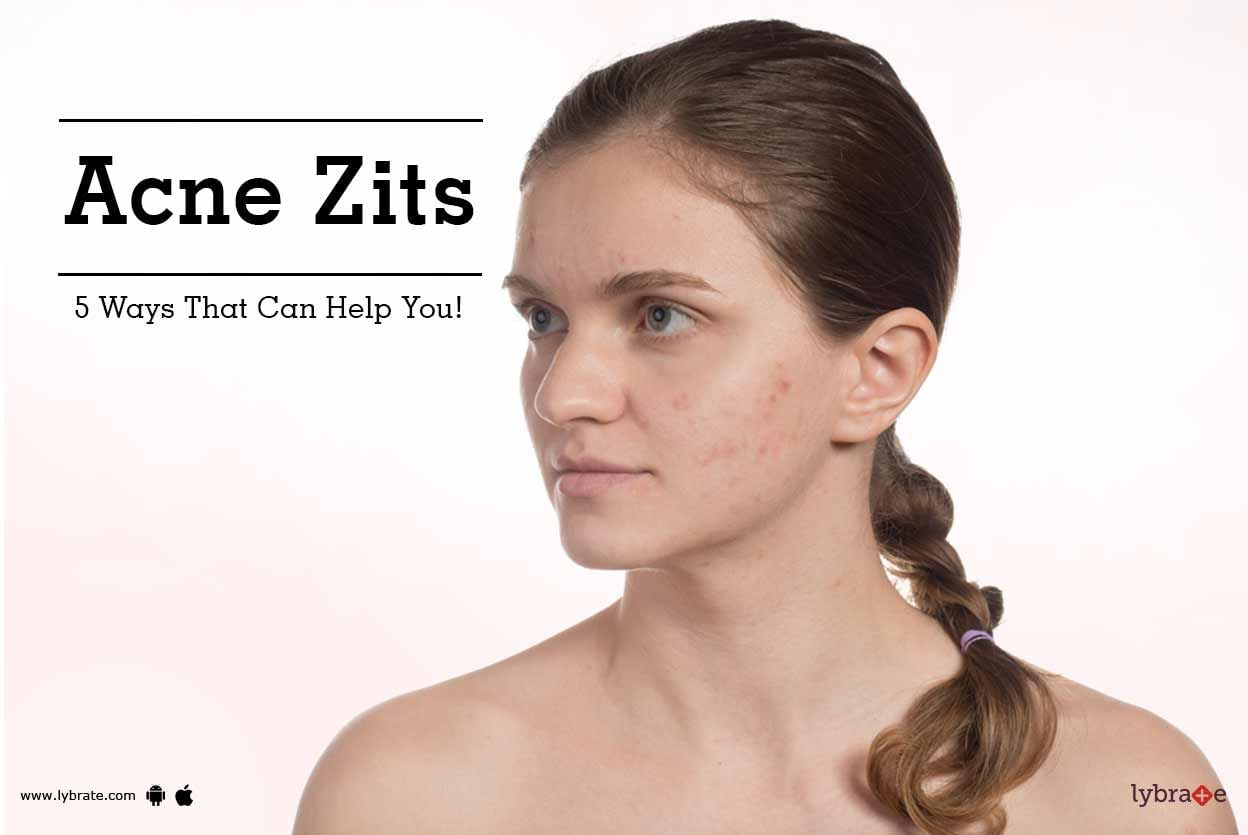 Acne Zits - 5 Ways That Can Help You!