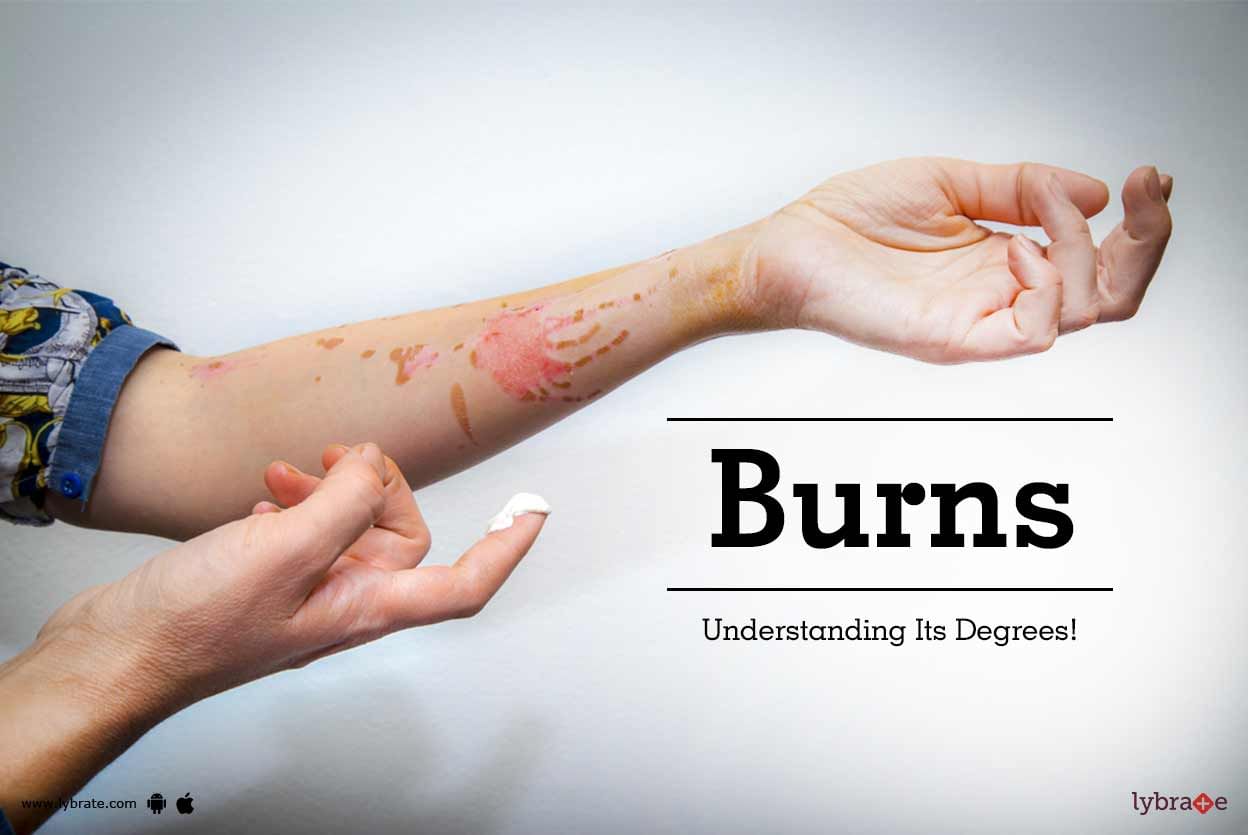 Burns - Understanding Its Degrees!