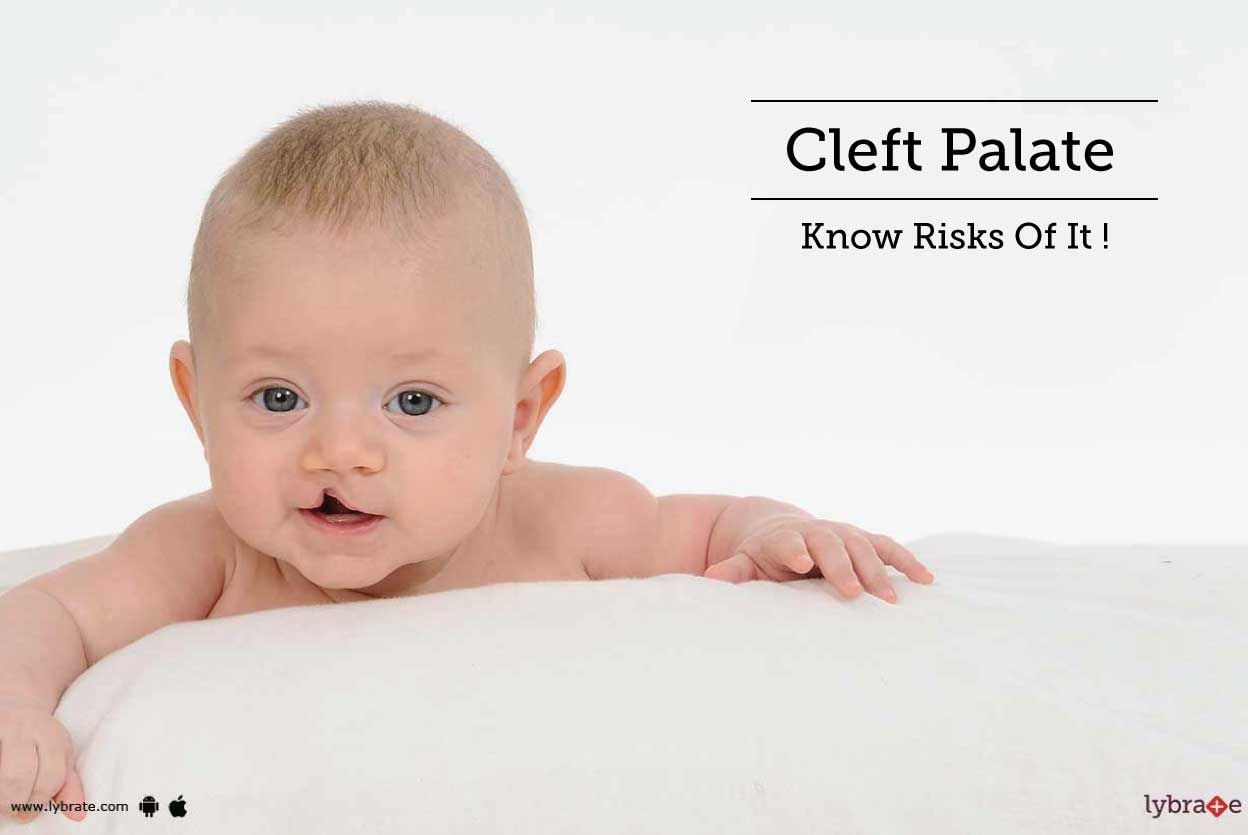 Cleft Palate - Know Risks Of It!