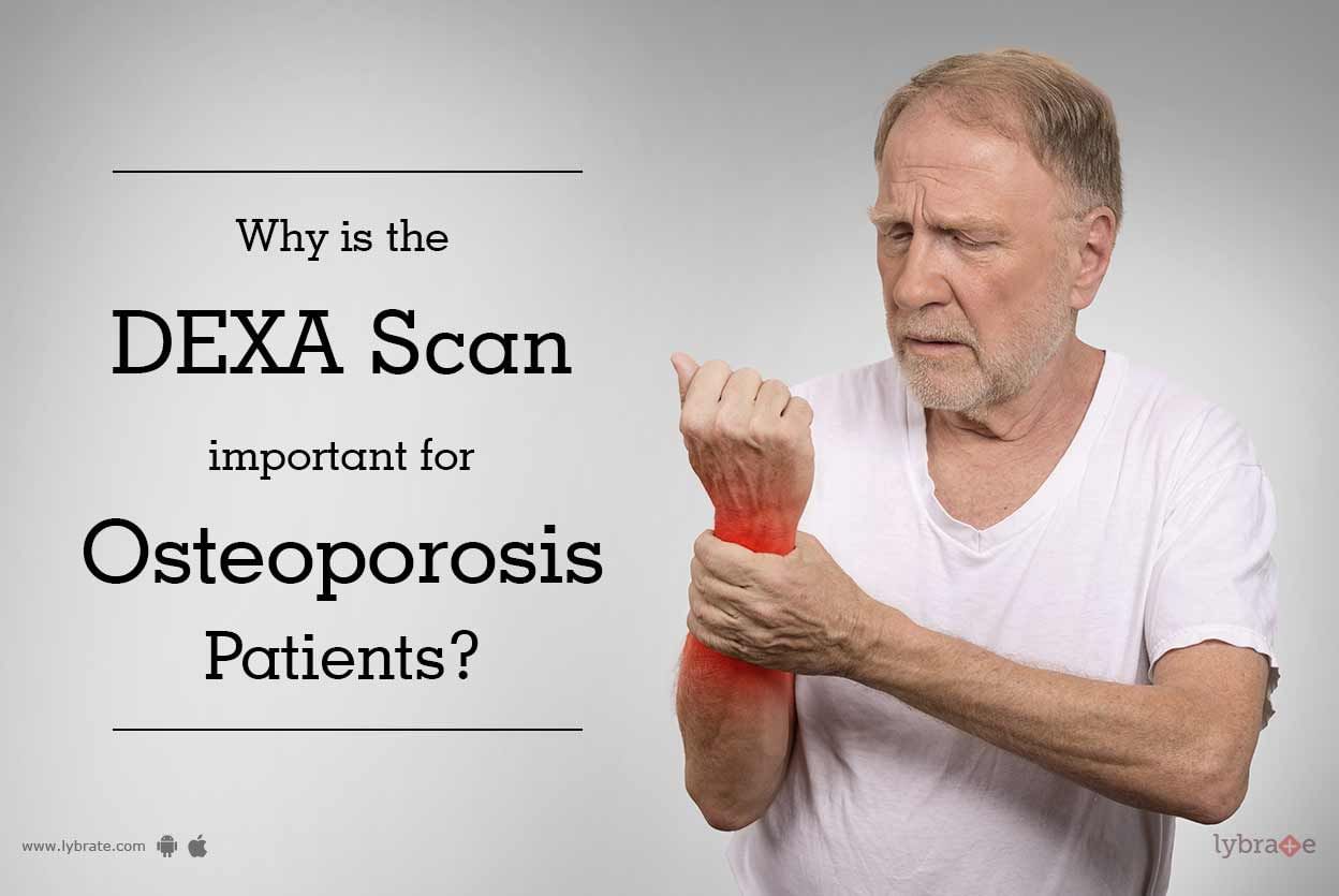 Why is the DEXA scan important for osteoporosis patients?
