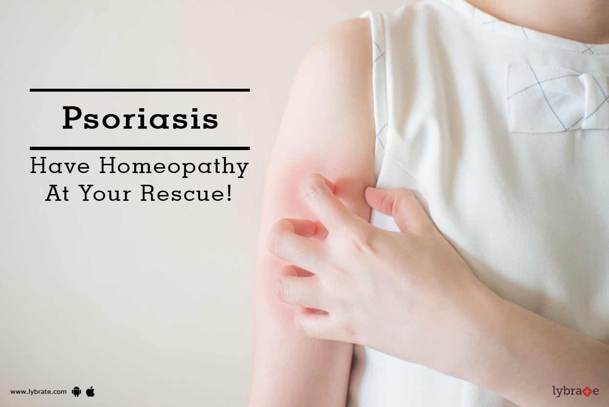 Psoriasis - Have Homeopathy At Your Rescue!