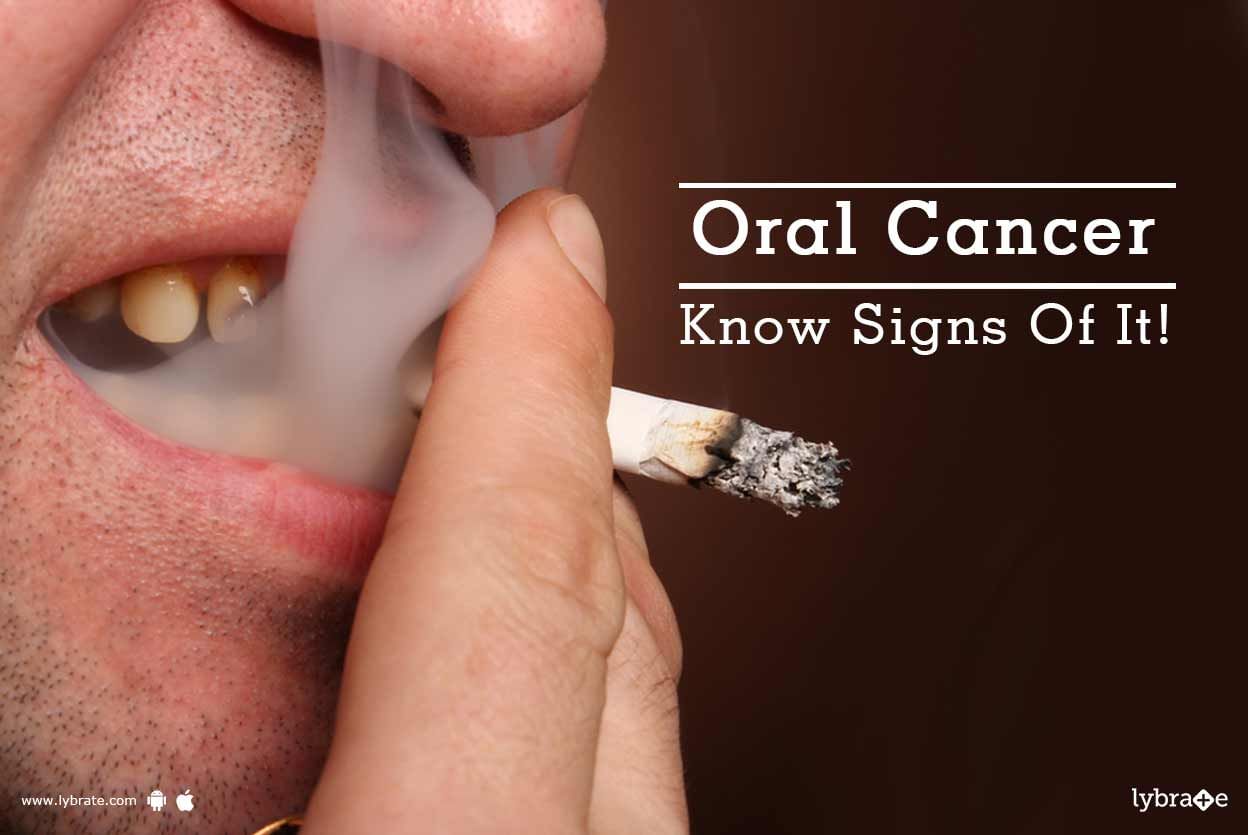 Oral Cancer - Know Signs Of It!