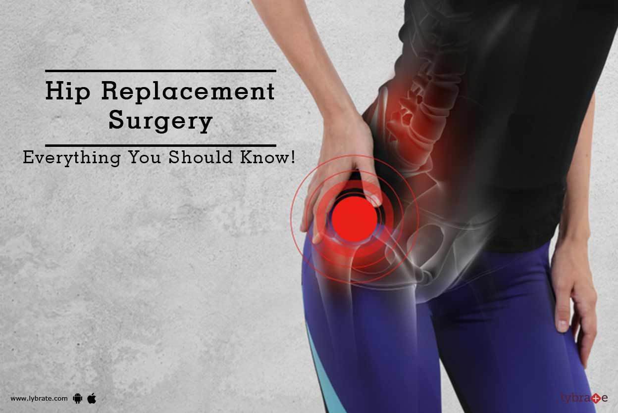 Hip Replacement Surgery - Everything You Should Know!