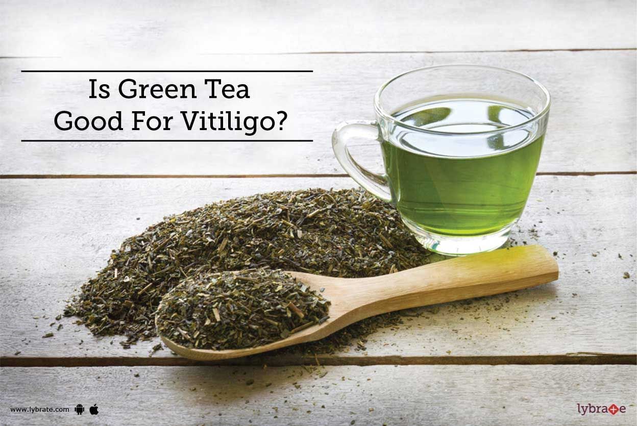 Is Green Tea Good For Vitiligo?