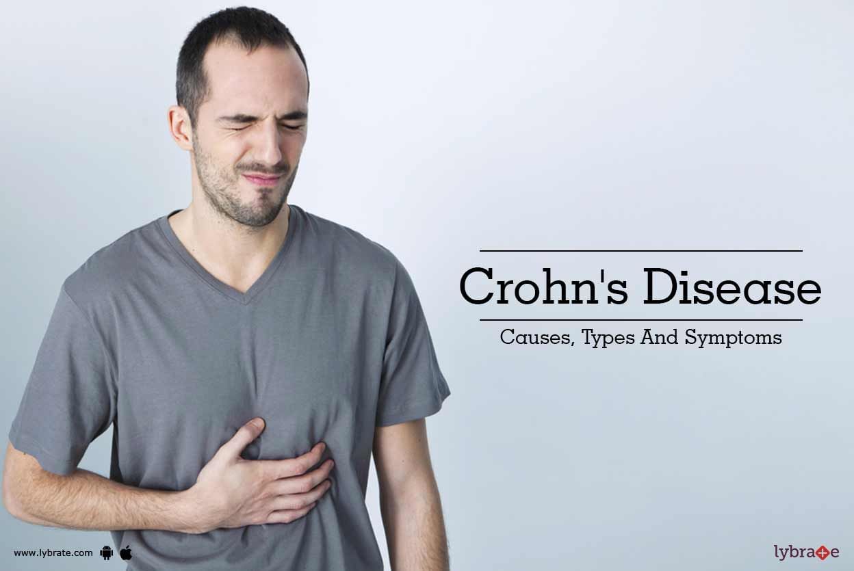 Crohn's Disease - Causes, Types and Symptoms!
