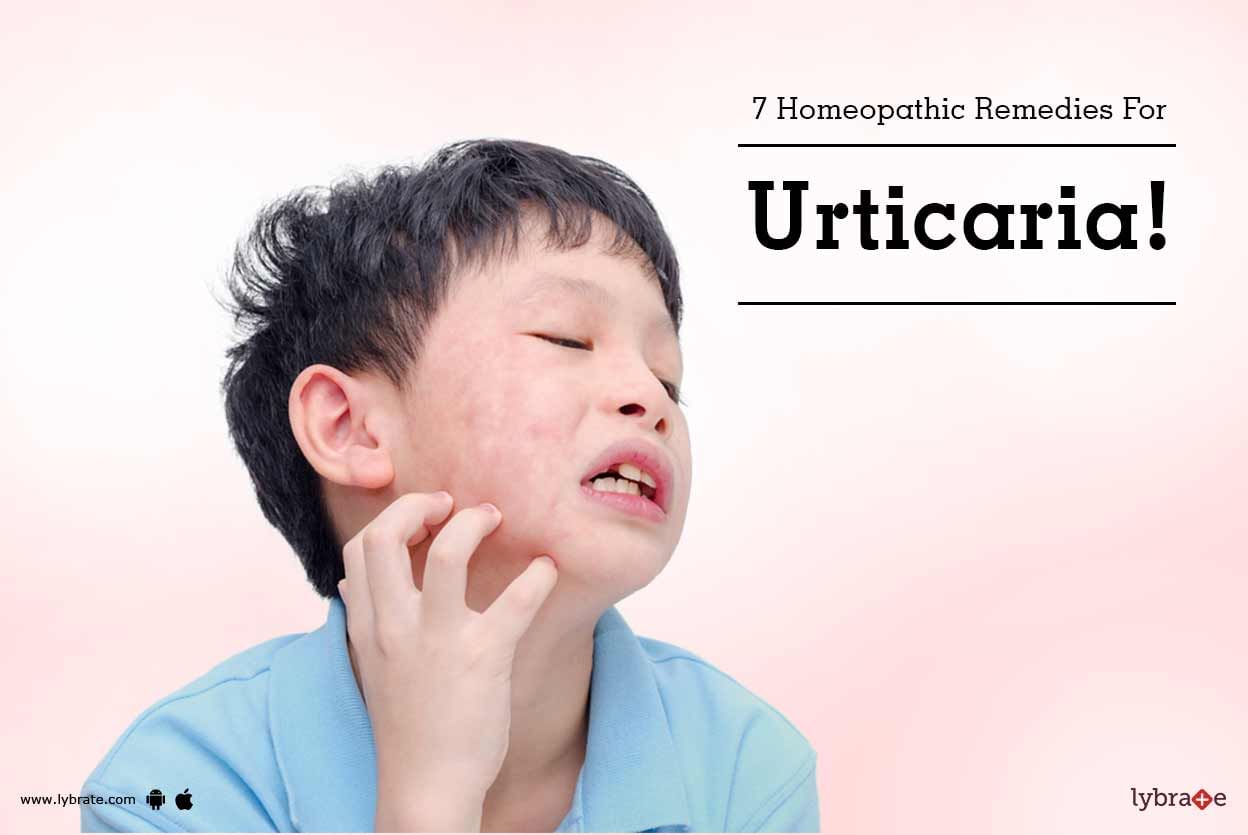 7 Homeopathic Remedies For Urticaria!