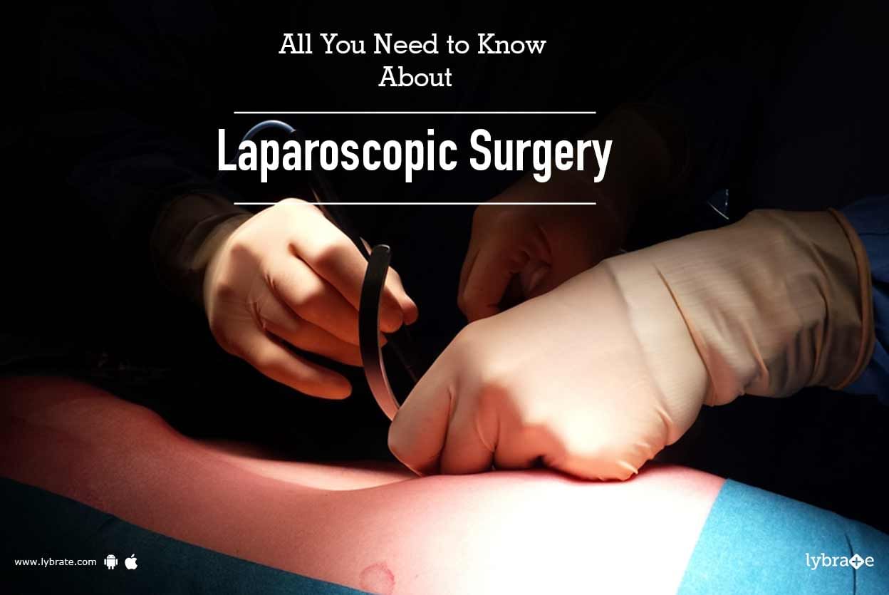 All You Need to Know About Laparoscopic Surgery