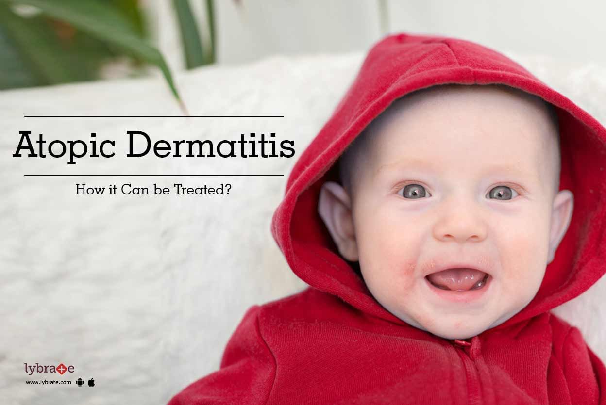 Atopic Dermatitis - How it Can be Treated? - By Isaac - International ...