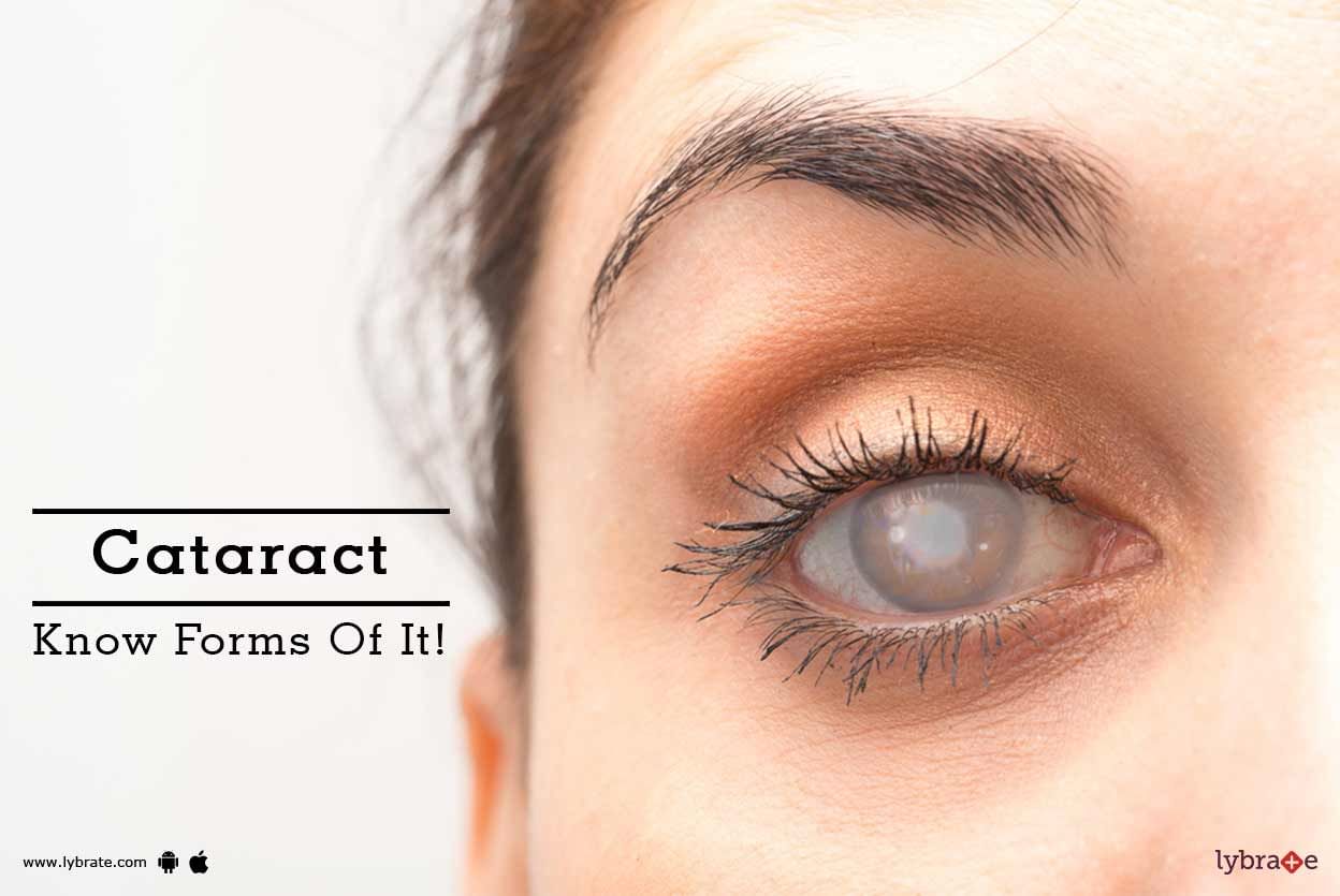 Cataract - Know Forms Of It!