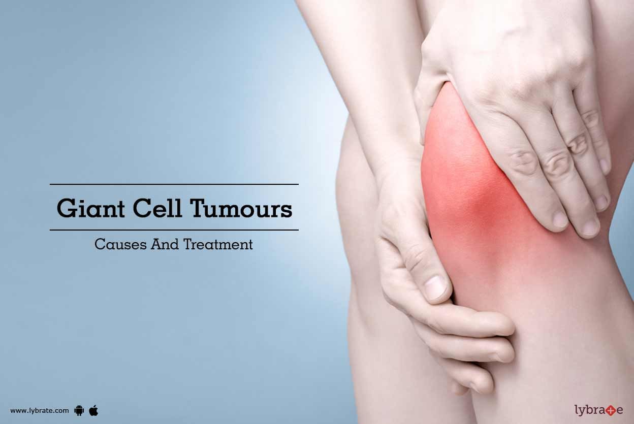 Giant Cell Tumours - Causes And Treatment