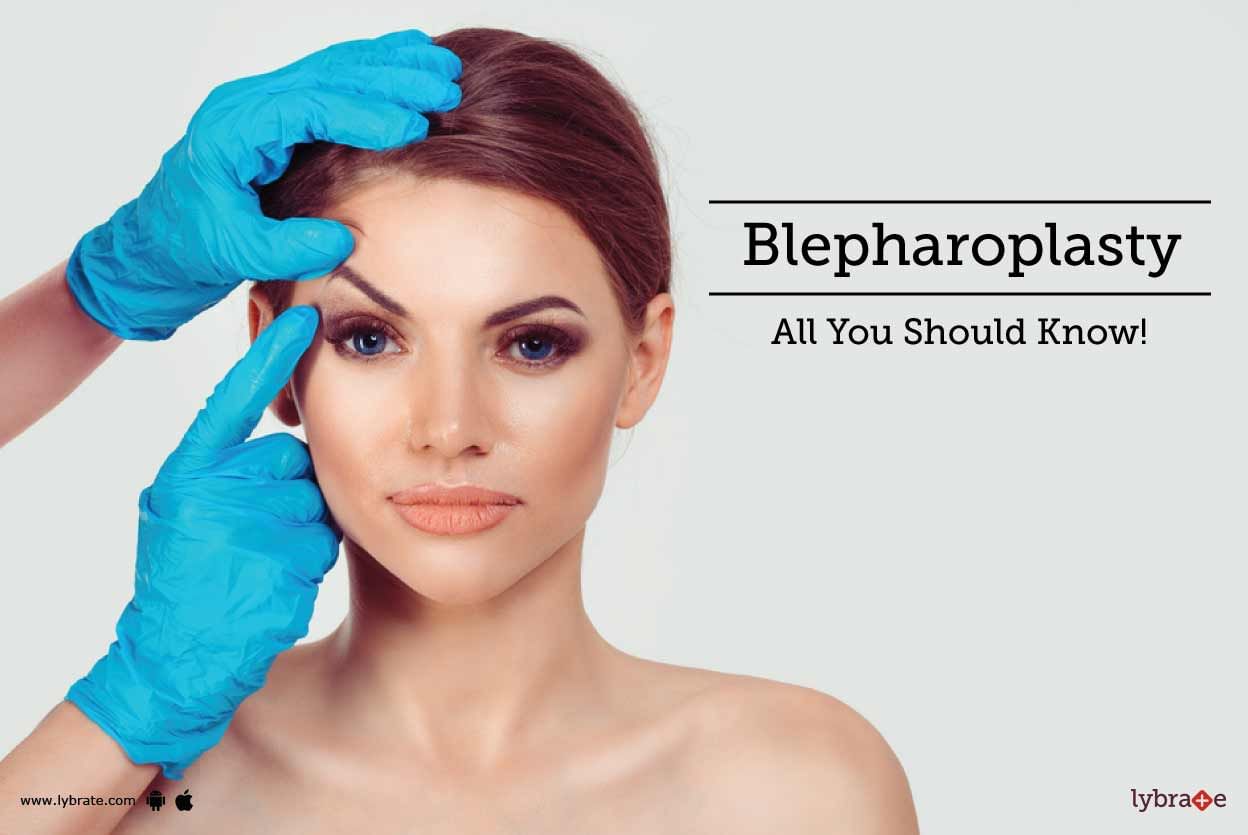 Blepharoplasty - All You Should Know!