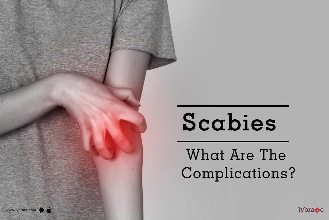 Scabies - What Are The Complications?