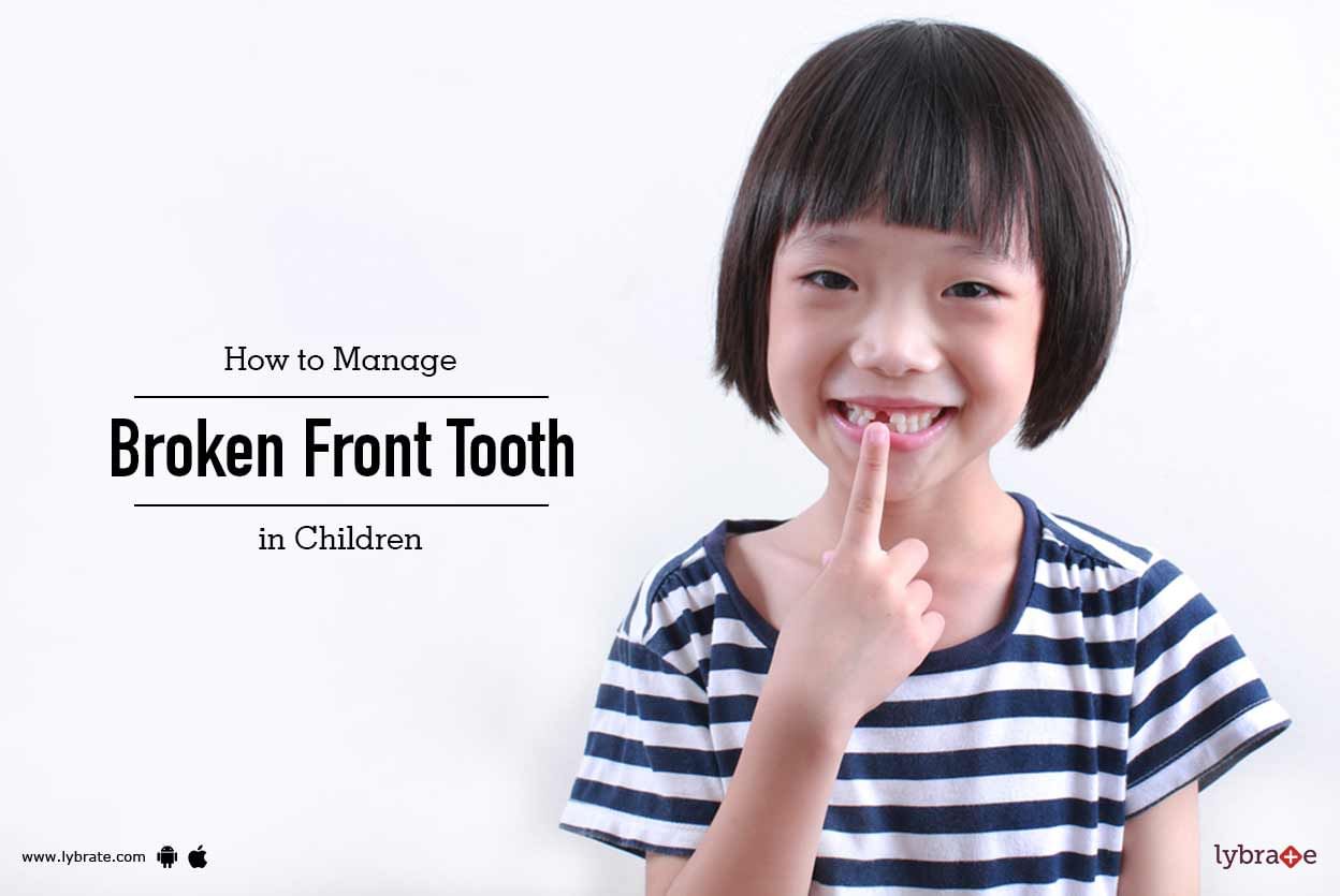 How to Manage Broken Front Tooth in Children