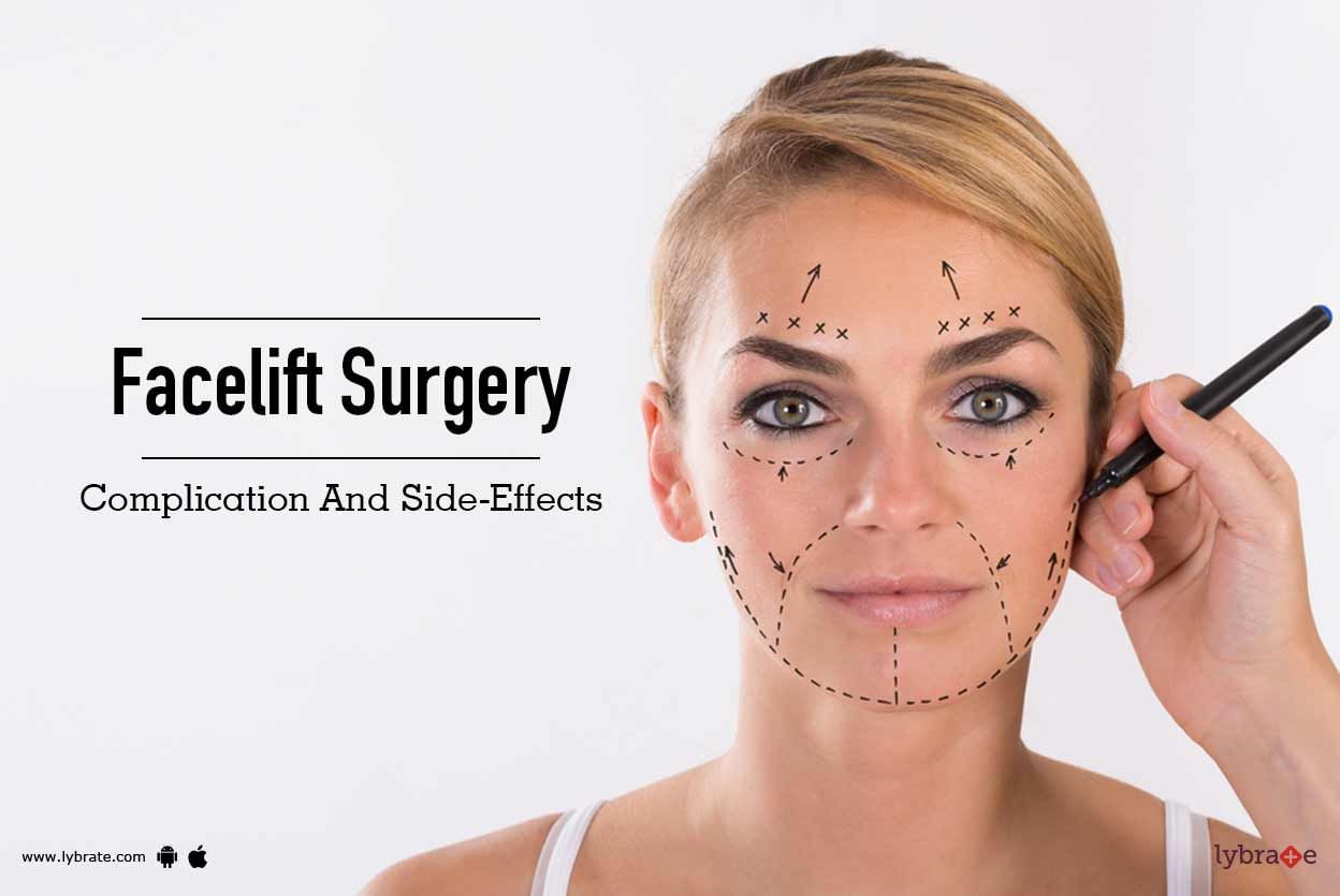 Facelift Surgery - Complication And Side-Effects