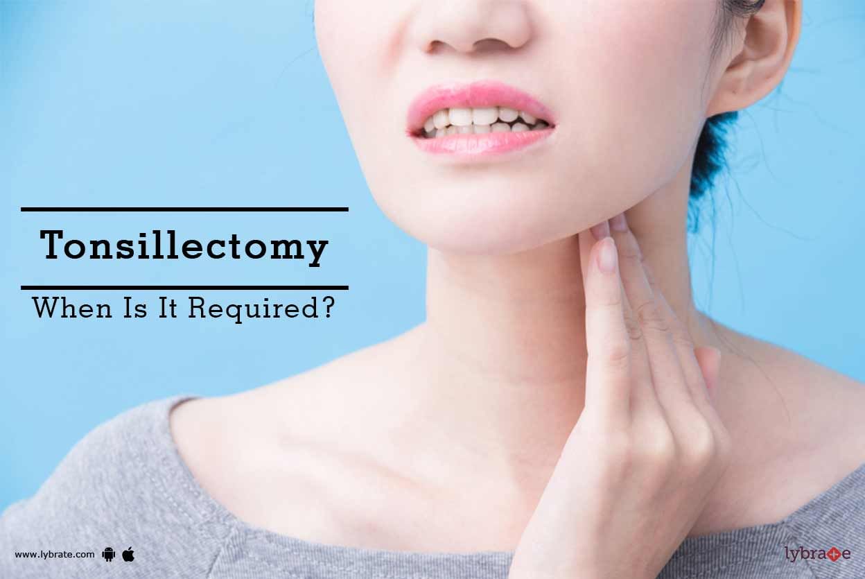 Tonsillectomy - When Is It Required?