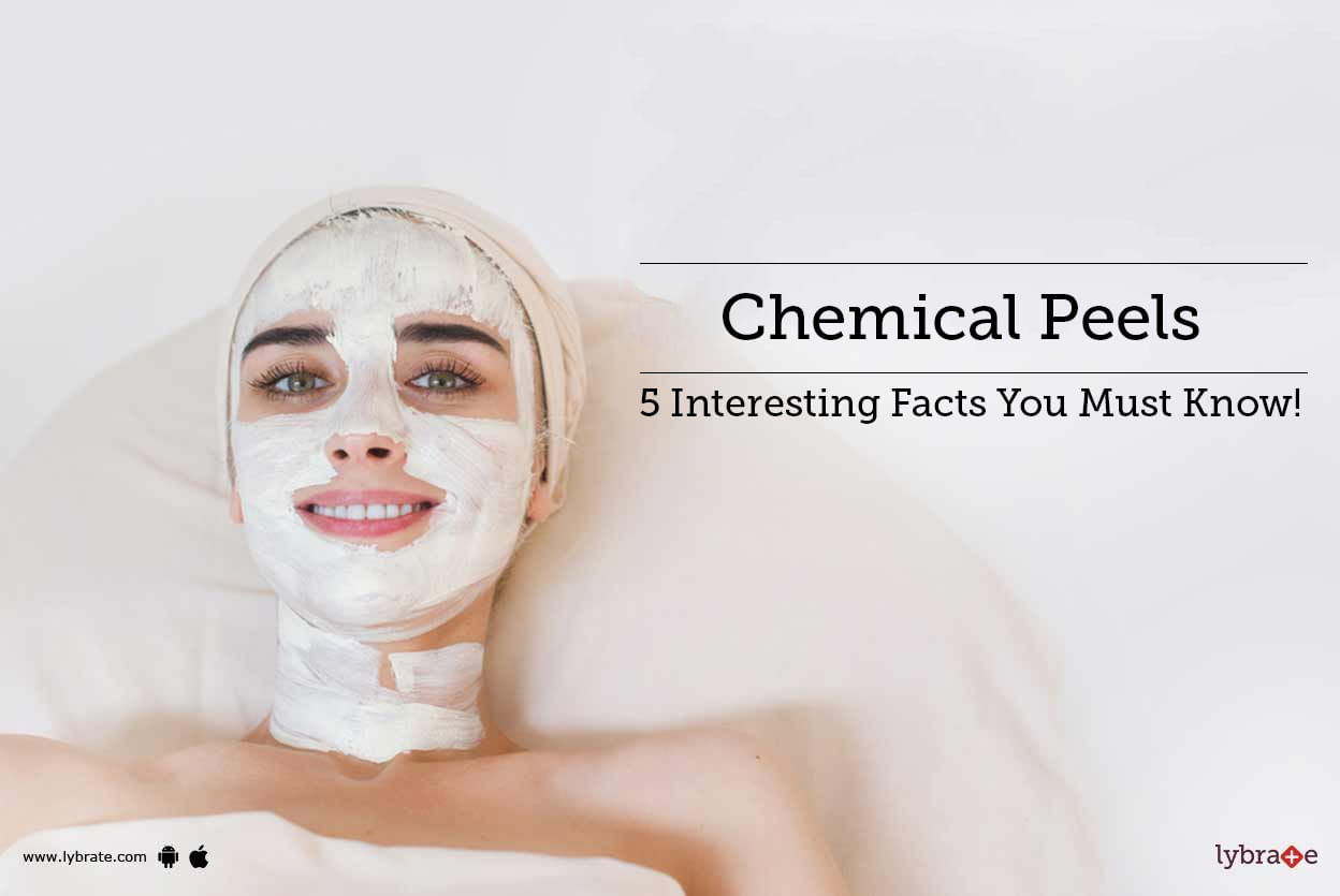 Chemical Peels - 5 Interesting Facts You Must Know!