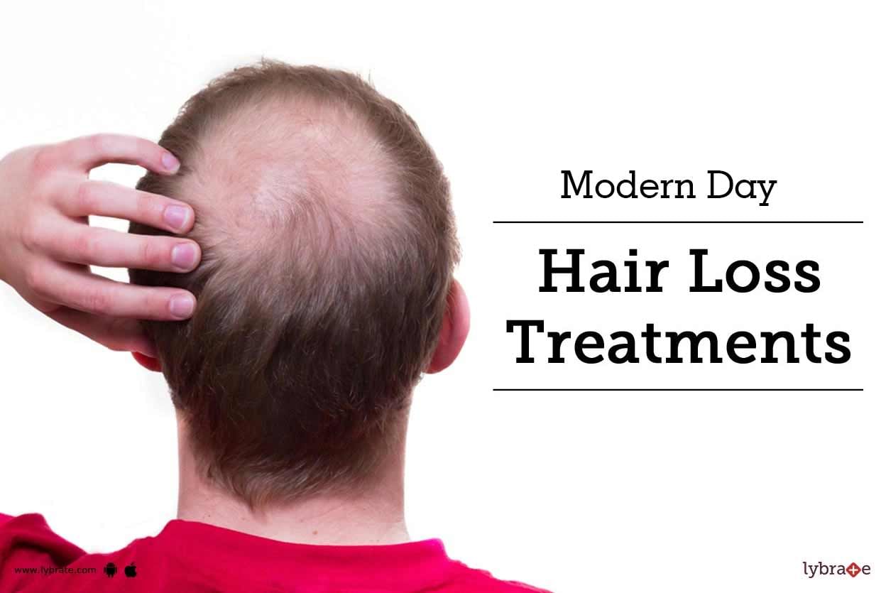 Modern Day Hair Loss Treatments
