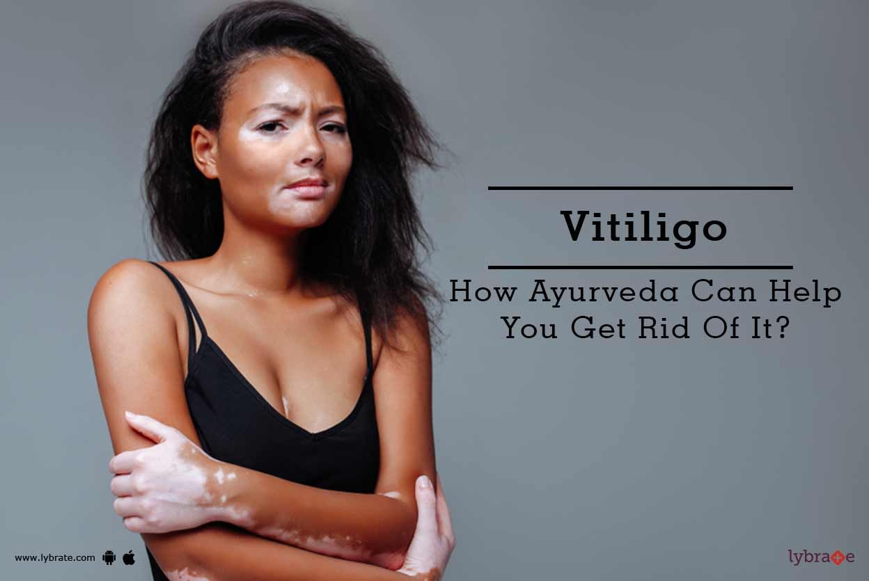 Vitiligo - How Ayurveda Can Help You Get Rid Of It?