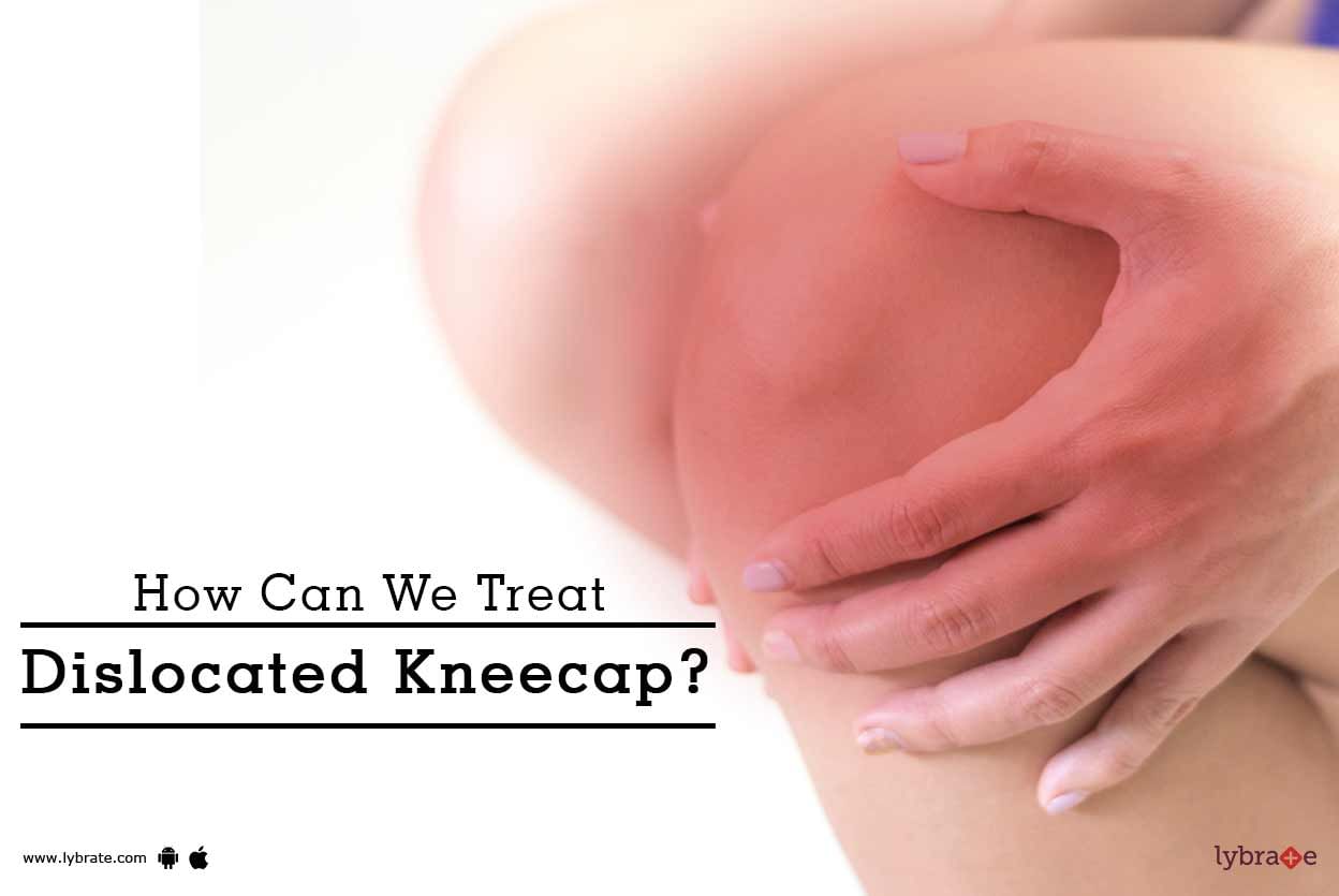 How Can We Treat Dislocated Kneecap?