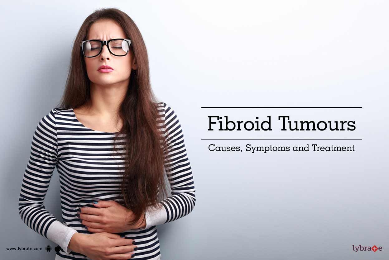 Fibroid Tumours - Causes, Symptoms and Treatment