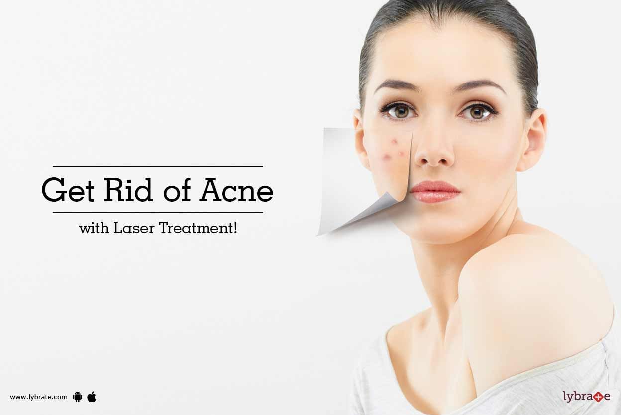 Get Rid of Acne with Laser Treatment!