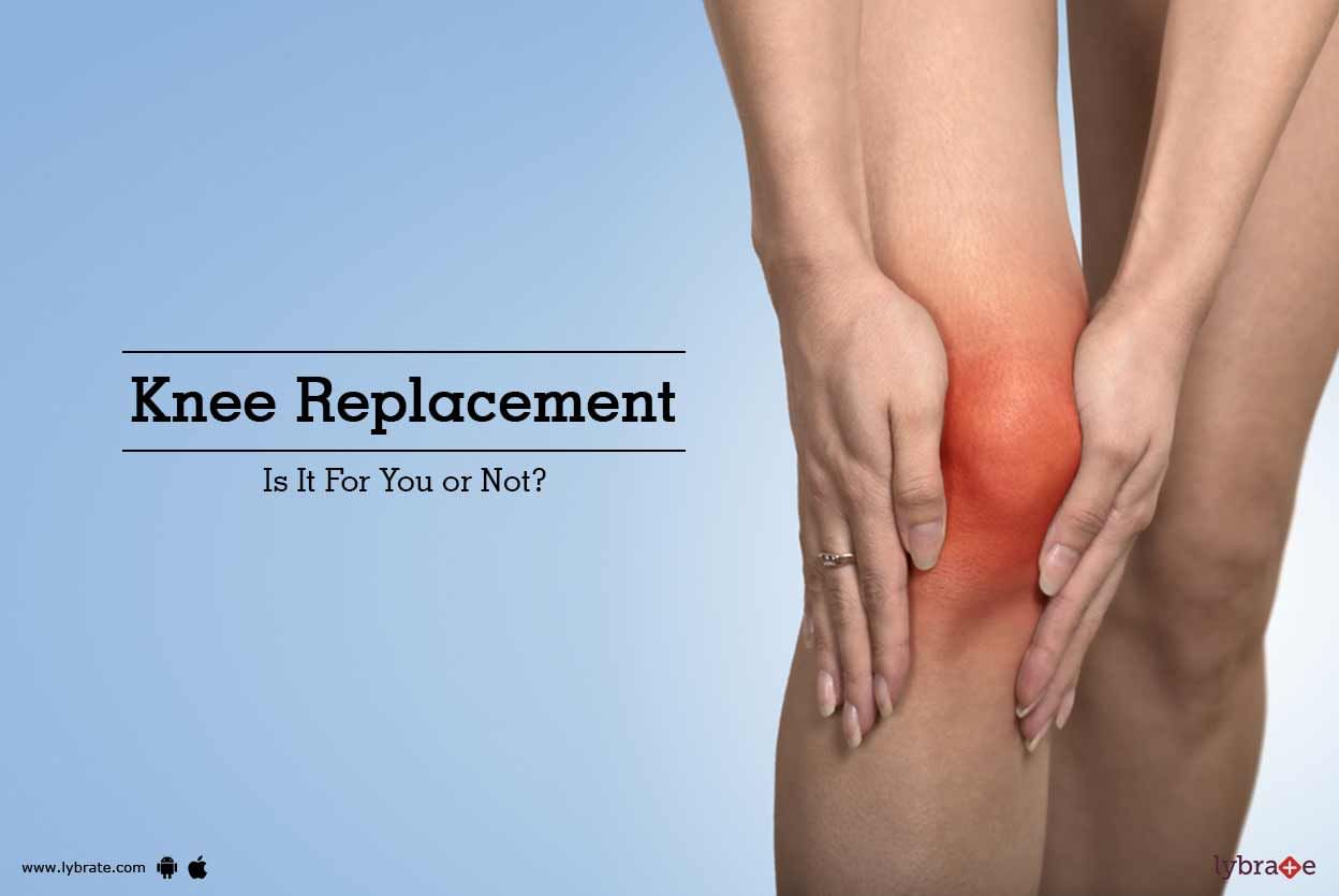 Knee Replacement - Is It For You or Not?
