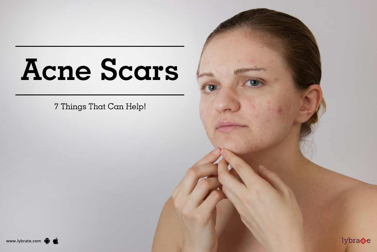 7 Best Home Remedies for Acne Scars on Face - Try Out Now